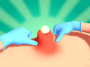 Jwèt Pimple peze sou entènèt